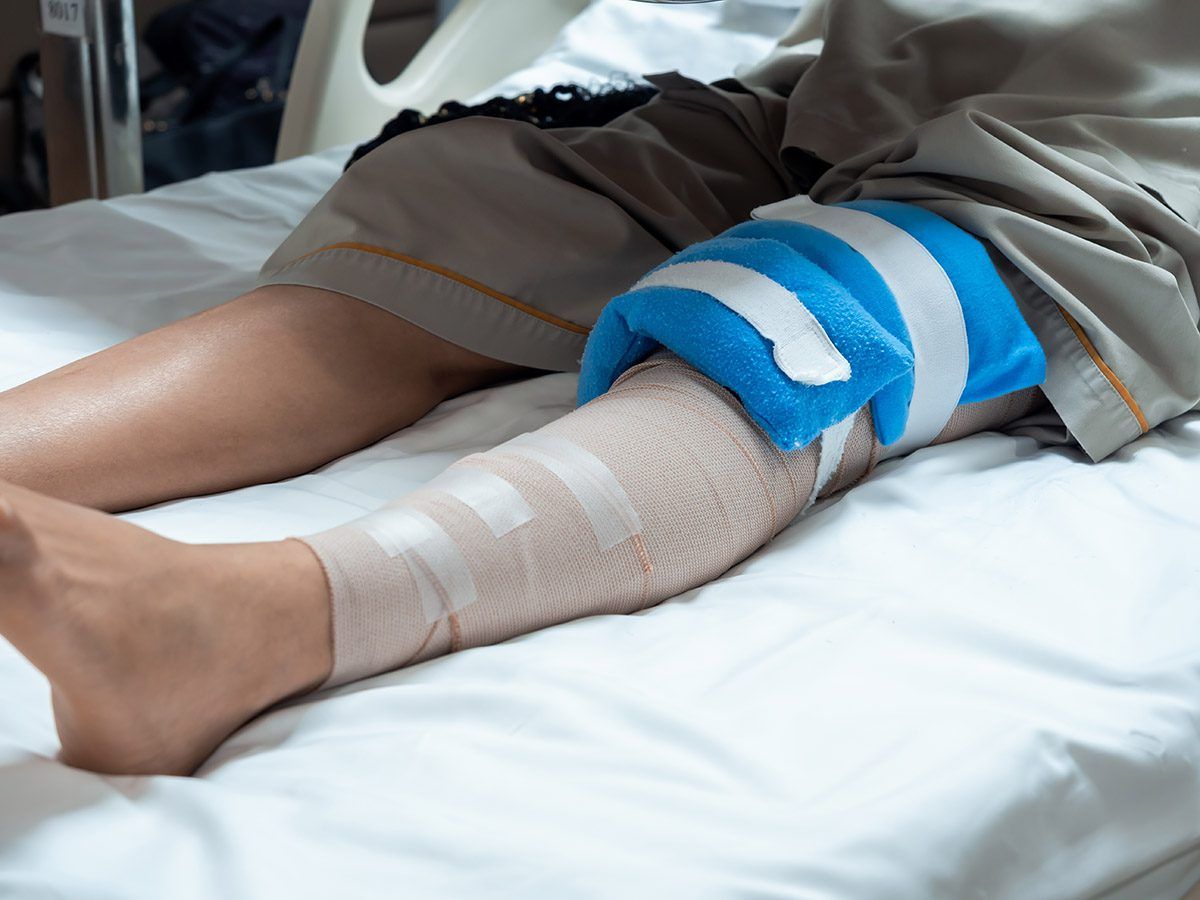Bandaged knee with a cold pack after knee surgery.